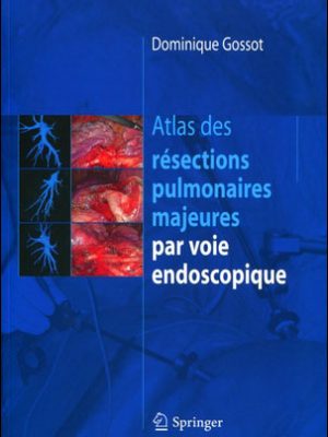 Livre FNAC Atlas des résections pulmonaires majeures par voie endoscopie