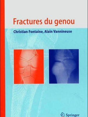 Livre FNAC Fractures du genou